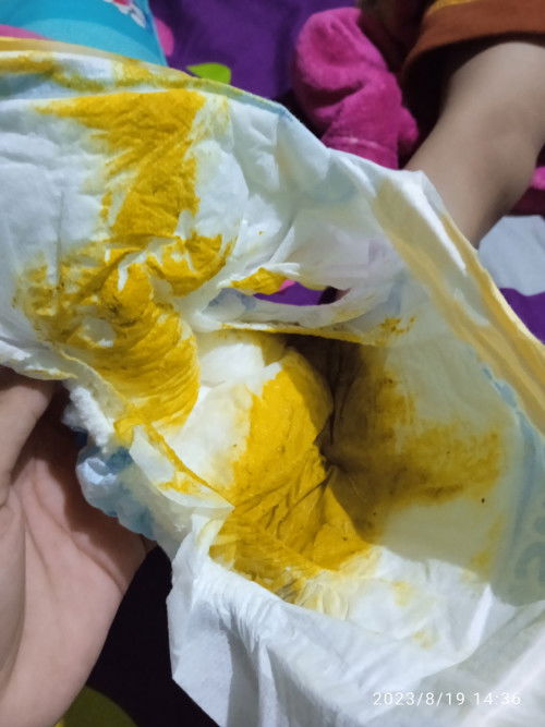 Maaf agak jorok warna feses bayi