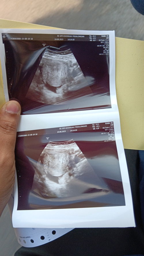 Cek USG pertama kali