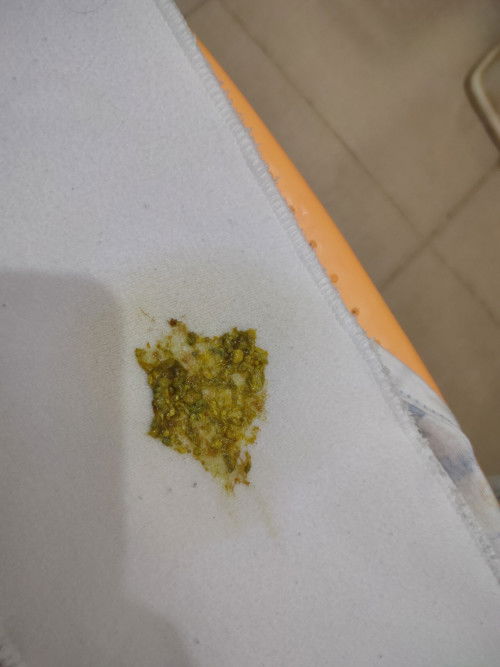 Bab bayi usia 1 bulan agak hijau