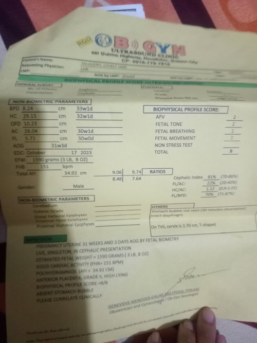 Sino Po Dito nakagaya ko na 34.92cm Yung panubigan nag worry Po kac ako