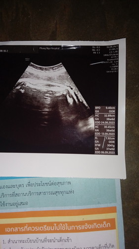 น้ำหนักลูกในท้อง3041 gใช่ไหมค่ะ