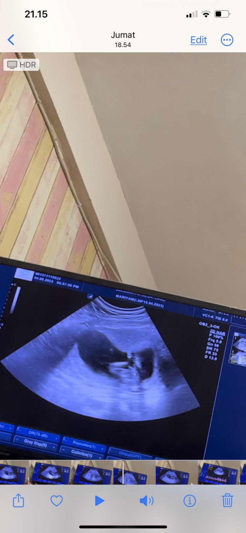 Kira kira menurut Bunda ini cewek apa cowo 😁