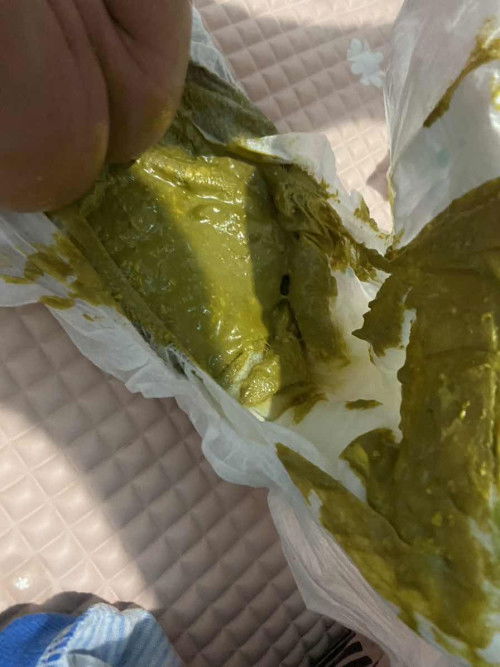 bingung dengan pup bayi ku