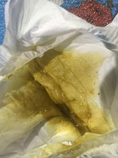 ท้องเสียไหมคะ