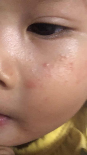 สอบถามหน่อยค่ะ ลูกเป็นแบบนี้