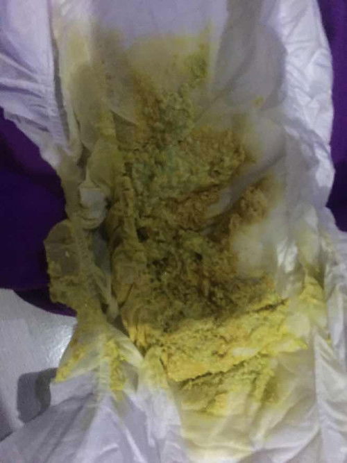 Bayi di obname 2 x dalam sebulan