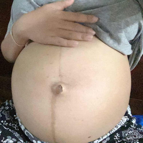 คลอด 22 กย