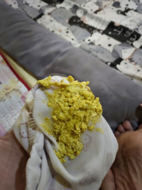 Poop Normal atau tidak?