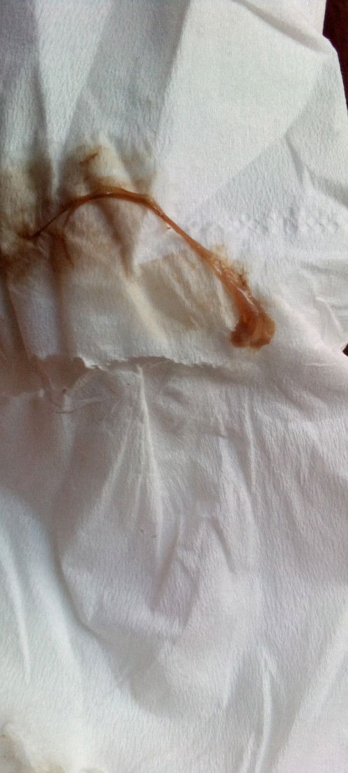 Keluar gumpalan lendir warna coklat