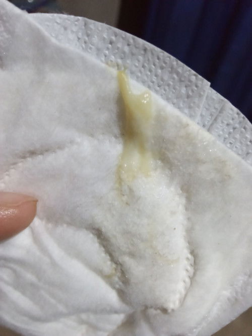 Maaf ya bun agak jorok,kmren sore keluar kaya gini di usia kndungan 39w..kira" tanda" apa ya bun?