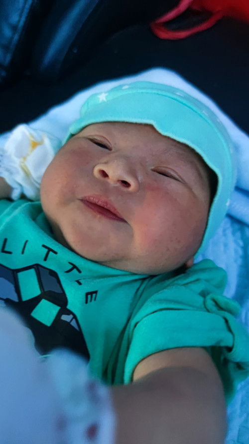 Induce Labor due to ruptured amniotic sac