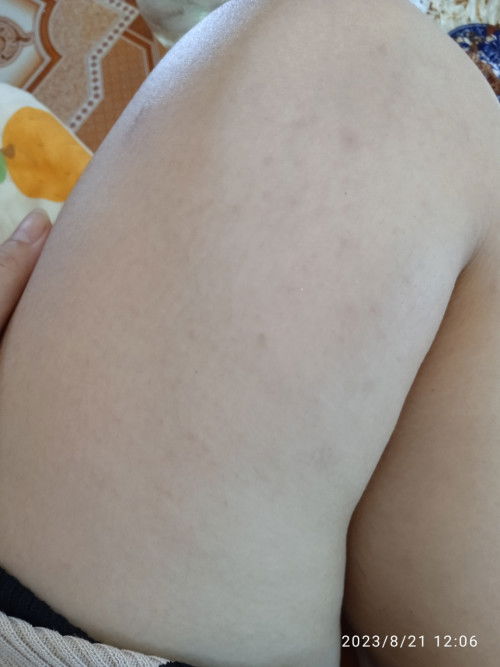 ตั้งครรภ์ท้อง2