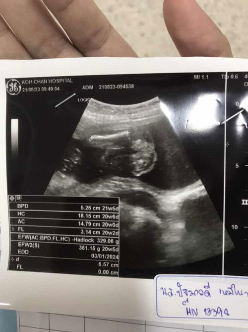 ช่วยดูทีค่ะเเม่ๆ