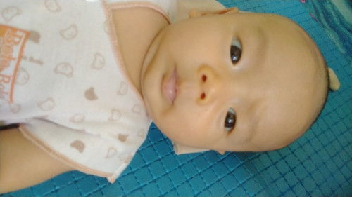 Bagian atas bibir agak biru