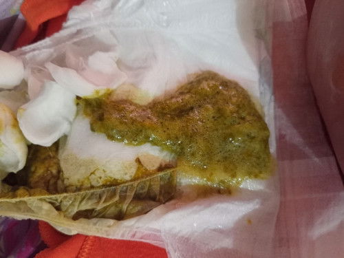 BAB bayi berwarna hijau