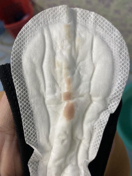 สอบทามแม่ๆ แบบนี้อันตรายไหมค่ะ