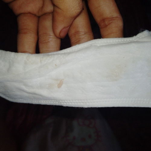 Mucus plug or normal discharge?