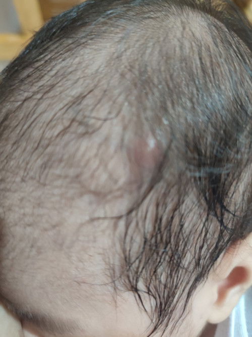 sino po sa inyo mommies nakaranas nito sa baby nyo