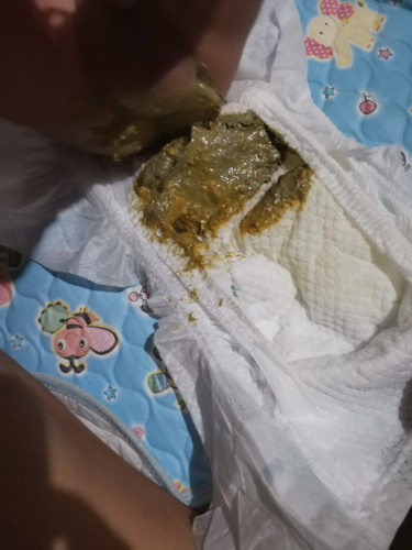 Bakit po kaya ganito ang tae ni baby, dark green po? Dahil po ba kaya sa vitamins na tinitake nya?
