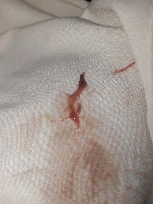 Tanong lang po mga momsh