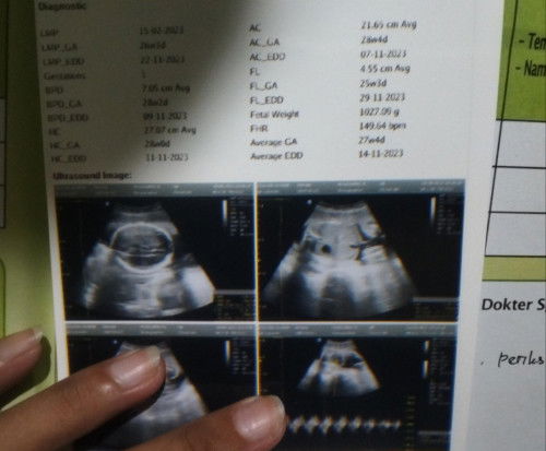 Berat badan janin udah 1 kilo