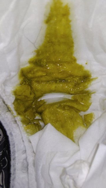 BAB BAYI HIJAU FREKUENSI LEBIH DARI 3X SEHARI