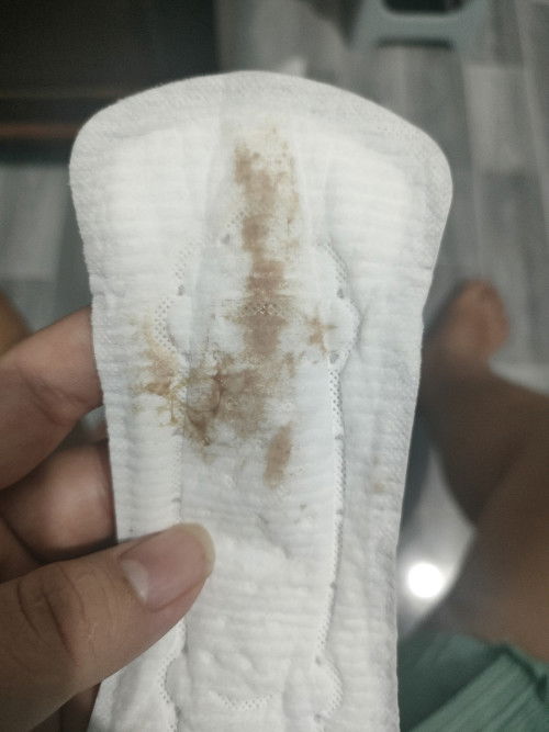 Cho e hỏi có mom nào đặt vòng nâng ctc mà bị ra dịch nâu giống e không ạ?