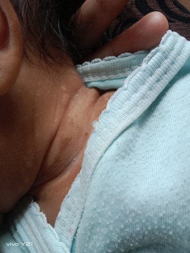 Bayi 2 bulan
