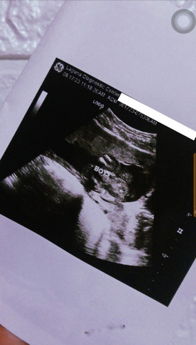 Gender sa ultrasound