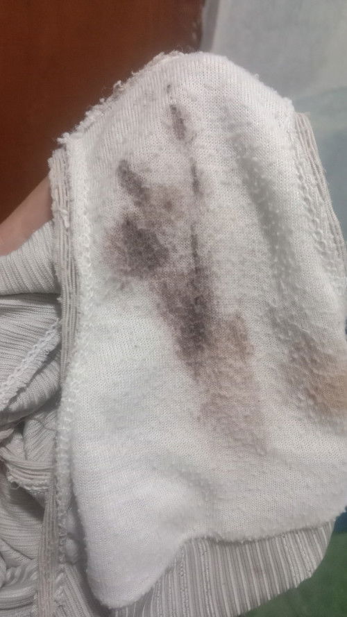 Flek usia kehamilan 8 week