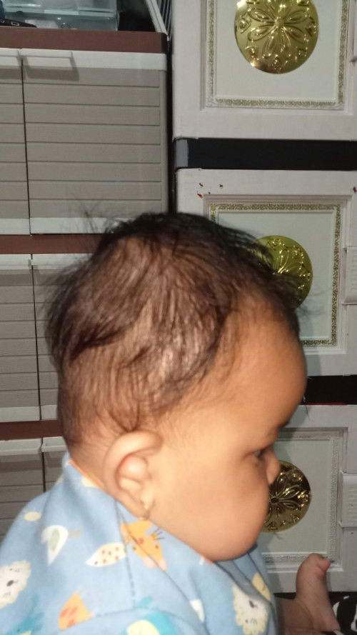 Kepala bayi 5 bulan datar