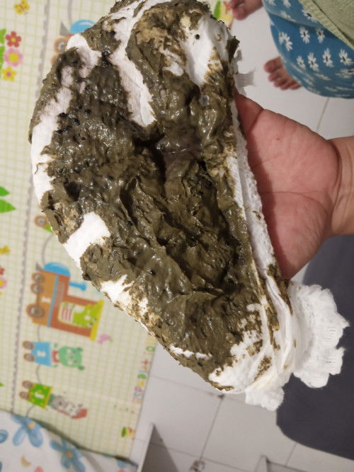 warna pup bayi ku hitam