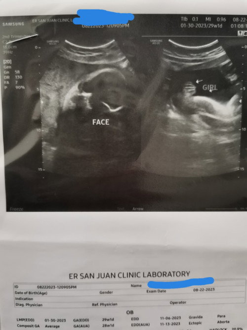 Ultrasound nung 6mos Boy, nung 7mos Girl.