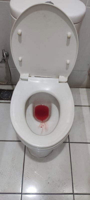 Apakah normal apabila setelah dilakukan pengecekan pembukaaan malah menjadi pendarahan?