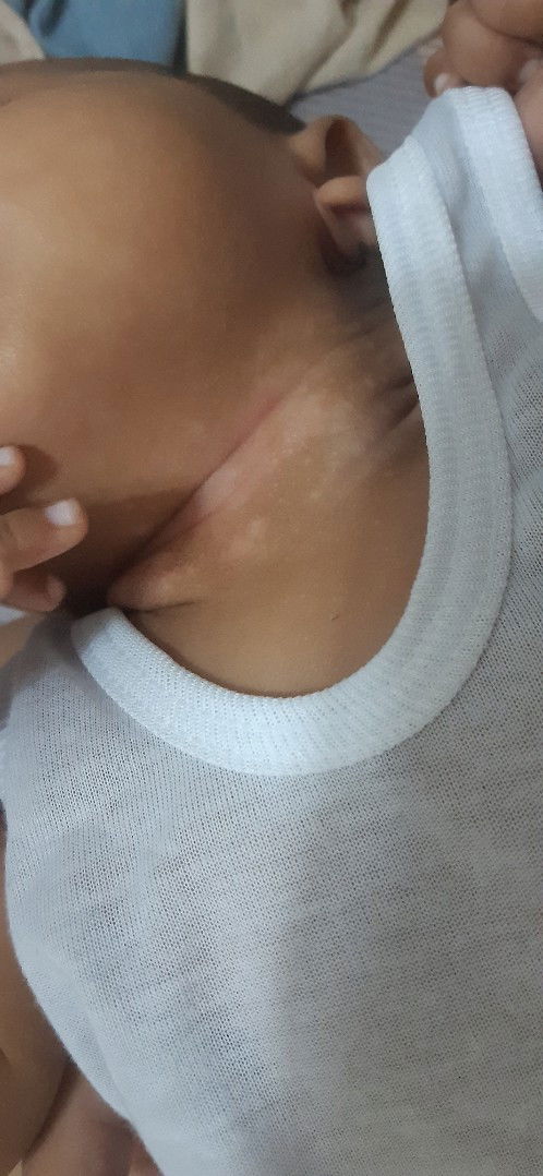 Hello po ask kong po kung ano ung puti puti sa leeg ng baby ko