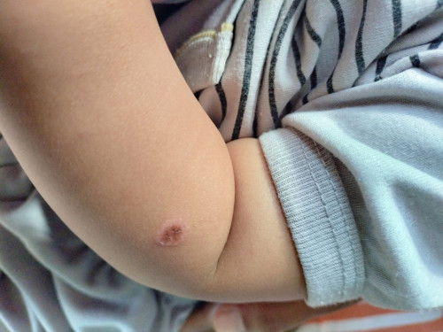 Lingkaran merah ( kaya kesundut roko )