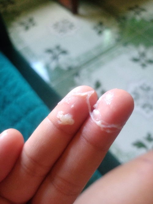 Tanong lang po, ito poba ang tinatawag na mucos plug? 
thanks.