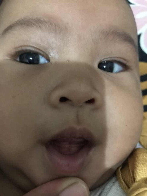 Anak 5bulan numbuh gigi