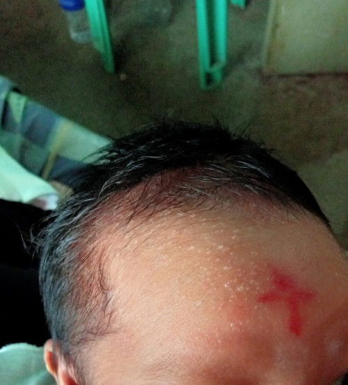 Paano kaya mawala ito at ano kaya ito?