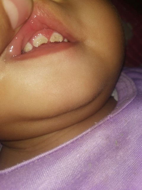 Gigi bayi bergerinjul