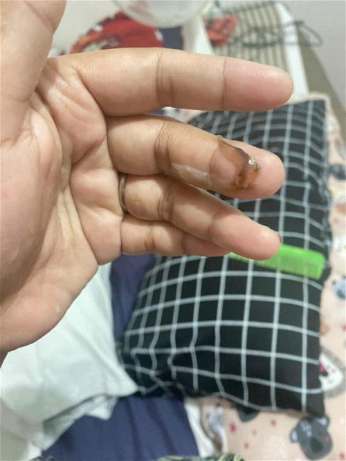 Keluar lendir kecoklatan kehamilan 38 minggu