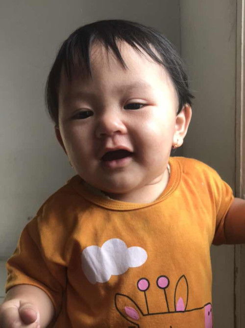 Bintik di seluruh badan campak atau biang keringat ?