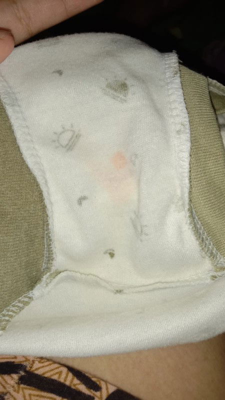 Serius tanya pipis anakku ada bercak orennya gini terus pipis e sedikit