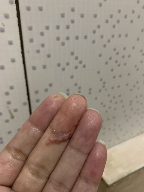 Ada lendir coklat dan merah