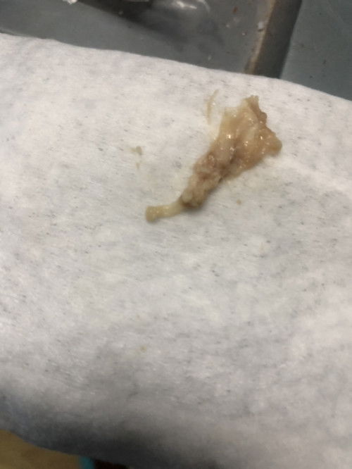 แบบนี้ไกล้คลอดรึยังค่ะ   ยังไม่มีอาการค่ะ  37+1ค่ะกำหนด 12กันยา