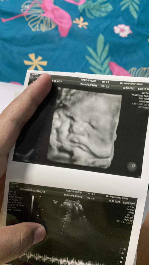 คลอดเดือนกันยายนไม่รู้จะถึงไหมมน้องตัวใหญ่มากกก💕❤️