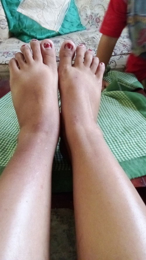 P0gejaoa di hamil trimester 3