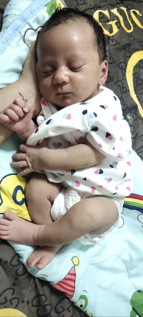 สอบถามแม่ๆ ลูกชายเป็นตุ่มผื่นแดงๆใสๆแบบนี้ผิดปกติไหมคะ ควรไปพบหมอไหม น้องเป็นเต็มหน้าเลยค่ะ