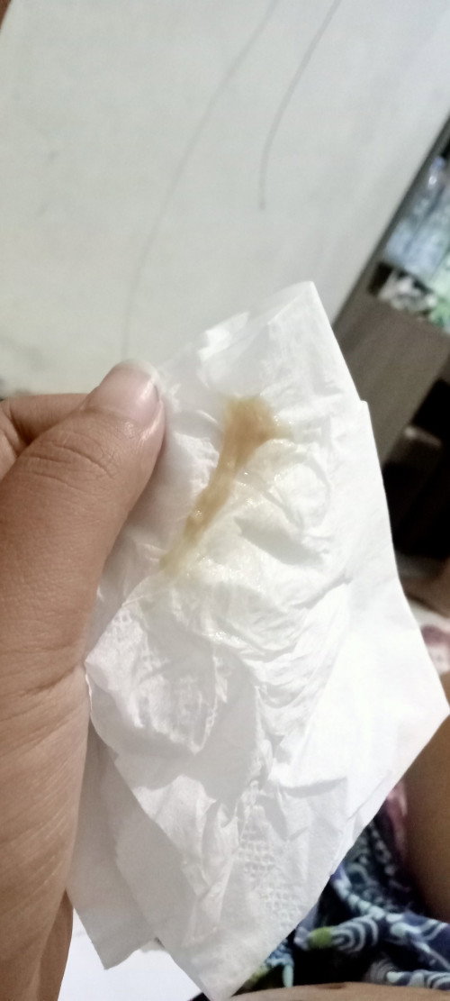 Keluar flek coklat
