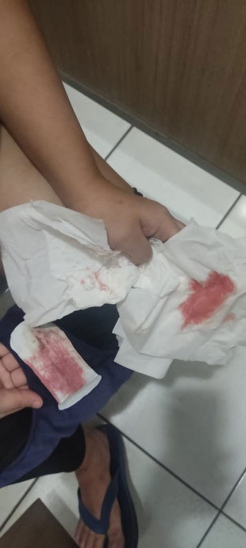 Apakah normal seperti ini bun?